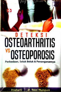Deteksi osteoarthritis vs osteoporosis : perbedaan, seluk beluk & penanganannya
